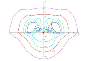 Medium Output graph